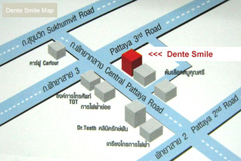 dente-smile-pattaya-map
